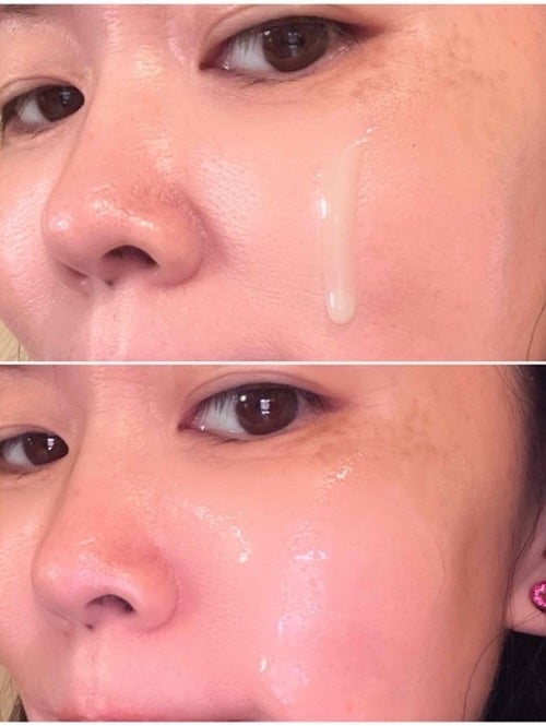 ReDRNエクソソームアンプル/Dr.nineteen/美容液を使ったクチコミ(4枚目)