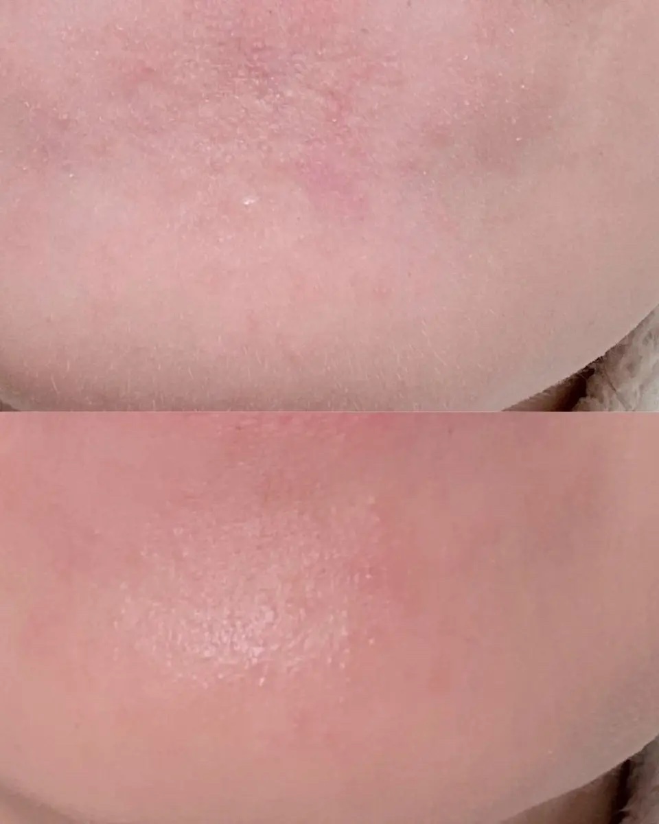 エリクシール シュペリエル つや玉ミスト/エリクシール/ミスト状化粧水を使ったクチコミ（2枚目）