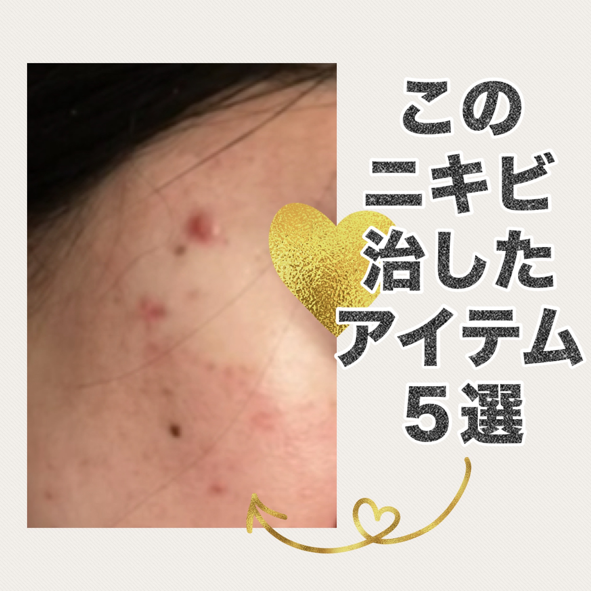 クリアフル ウォッシュ/オルビス/洗顔フォームを使ったクチコミ（1枚目）