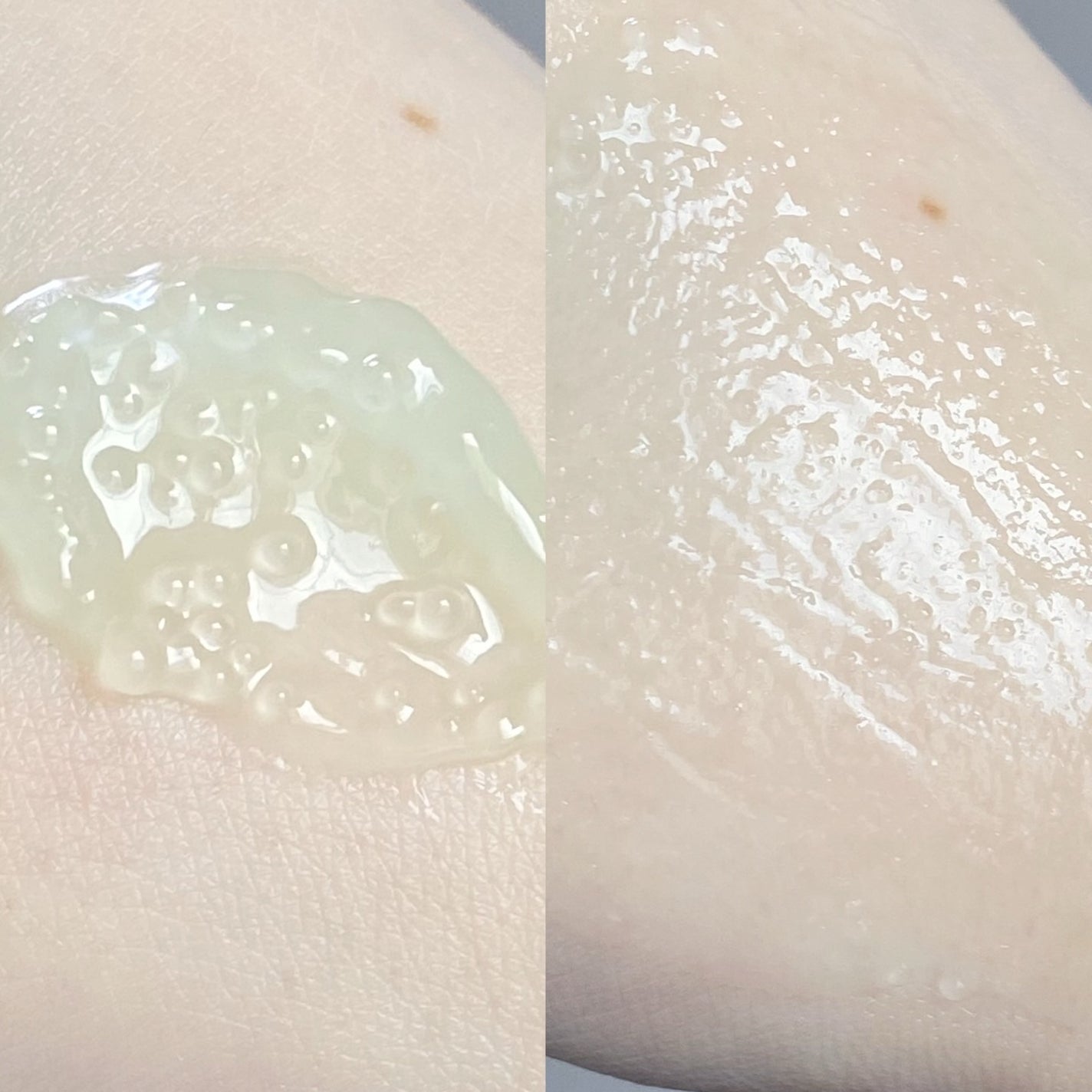 エクソボールセラム/USNEAR/美容液を使ったクチコミ(7枚目)