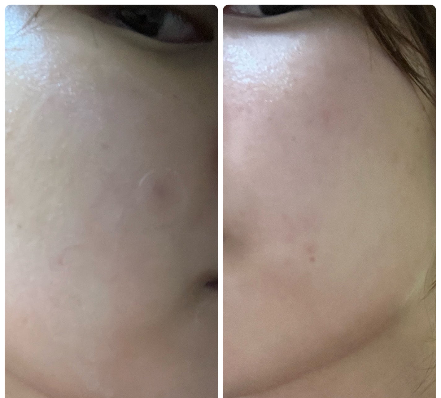 ぽむ on LIPS 「1枚目 2025.12.22エピデュオ 831日目2枚目 20..」(3枚目)