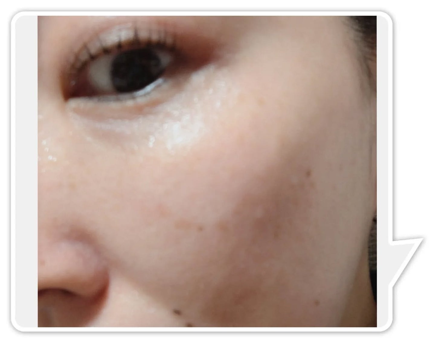 バイオスキンエッセンスプラス/Bionist (ビオニスト)/美容液を使ったクチコミ(7枚目)