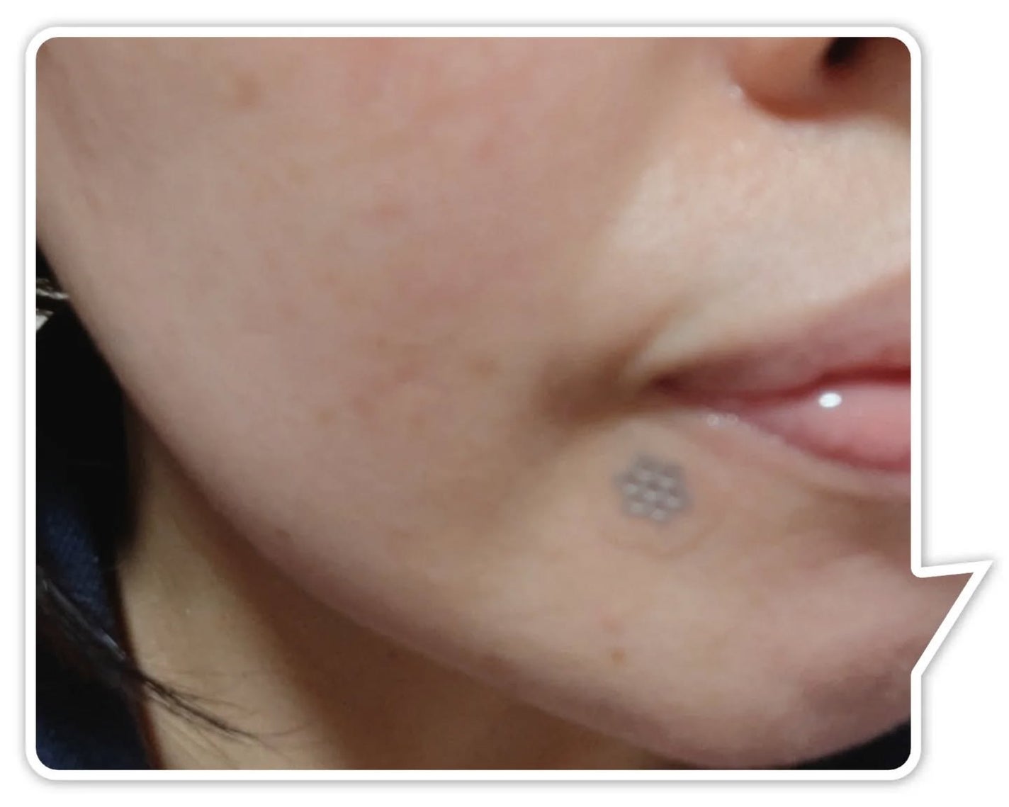 ACマグネシウムパッチ/スノーツープラス/シートマスク・パックを使ったクチコミ(4枚目)