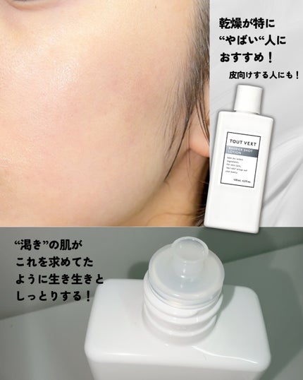 バリアショットローション/TOUT VERT/化粧水を使ったクチコミ(5枚目)