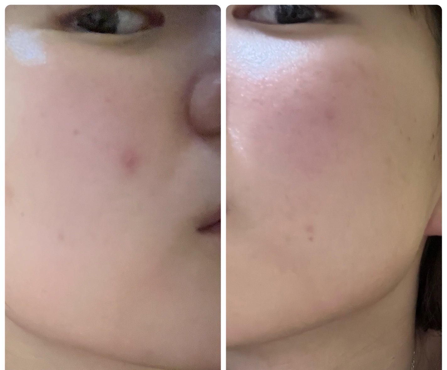 ぽむ on LIPS 「1枚目 2025.12.22エピデュオ 831日目2枚目 20..」(4枚目)