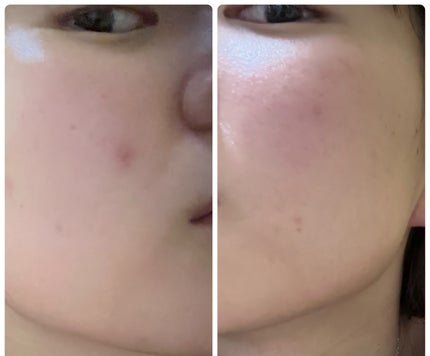 ぽむ on LIPS 「1枚目 2025.12.22エピデュオ 831日目2枚目 20..」(4枚目)