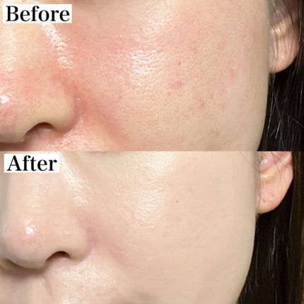 アイシーフィットカバークッションEX/TFIT/クッションファンデーションを使ったクチコミ(4枚目)