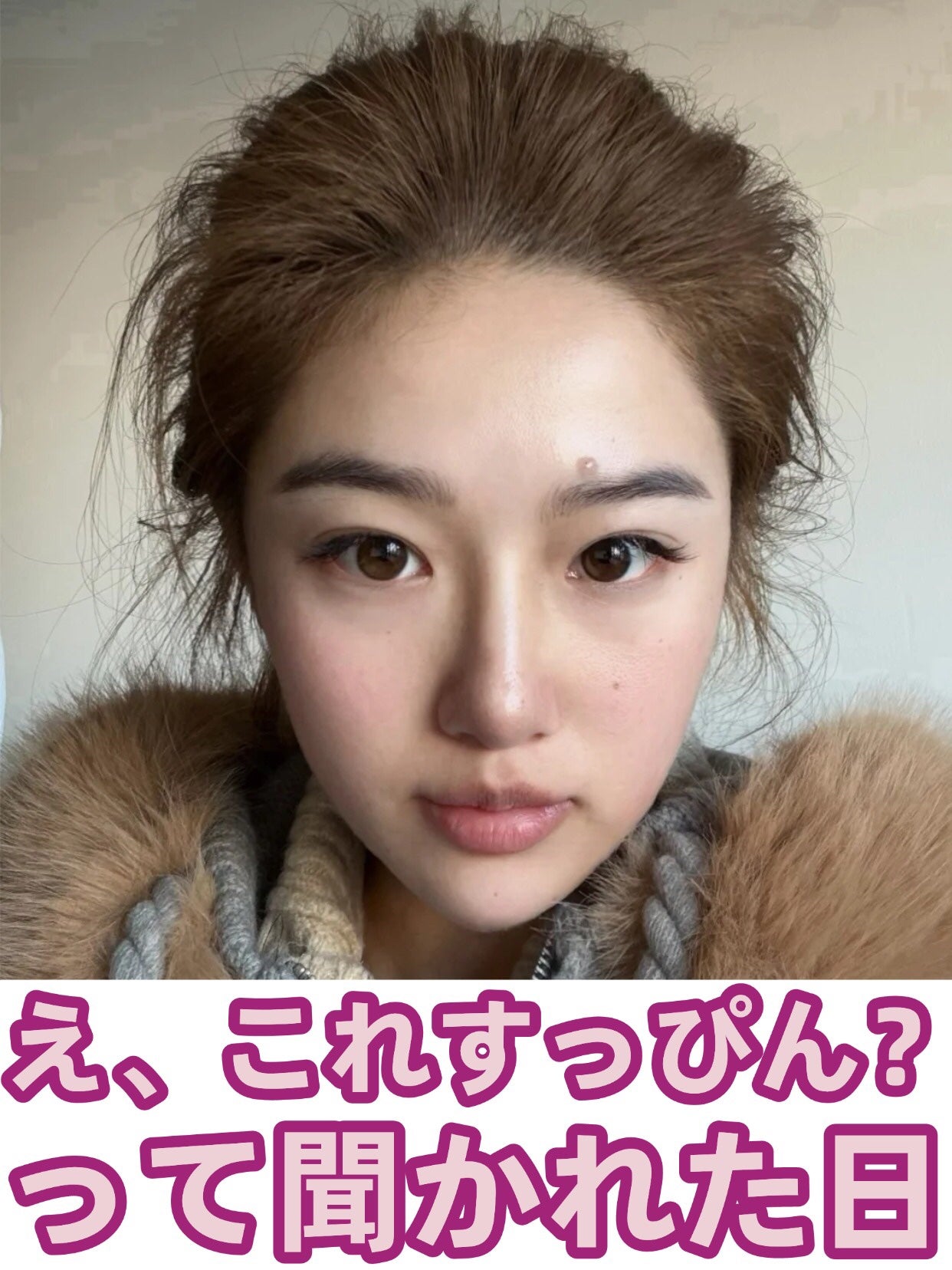 アネトス アクネケア トリートメント セラム/Anetos/美容液を使ったクチコミ(1枚目)