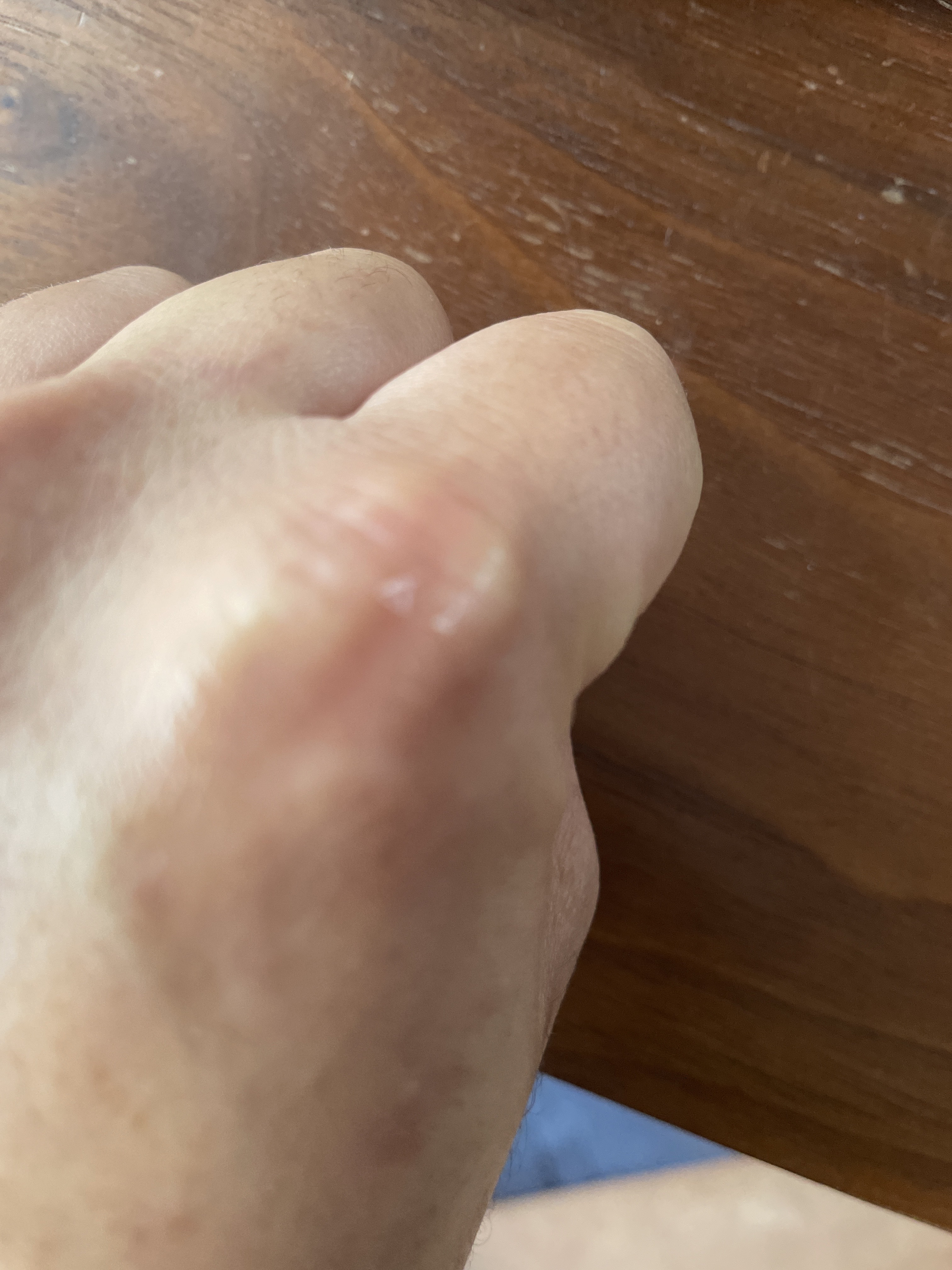 ダーメラ ルミショット・Wビタセラム/Dermela/美容液を使ったクチコミ（3枚目）