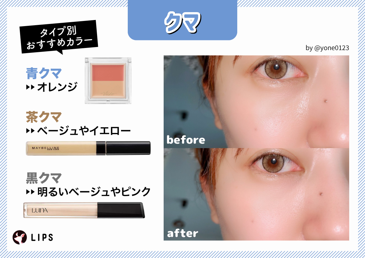 クマのタイプ別おすすめカラーは、青クマならオレンジ、茶クマならベージュやイエロー、黒クマなら明るいベージュやピンク。