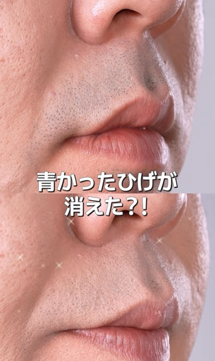 コンシールブレンダーパレット/LUNA/パレットコンシーラーを使ったクチコミ(1枚目)