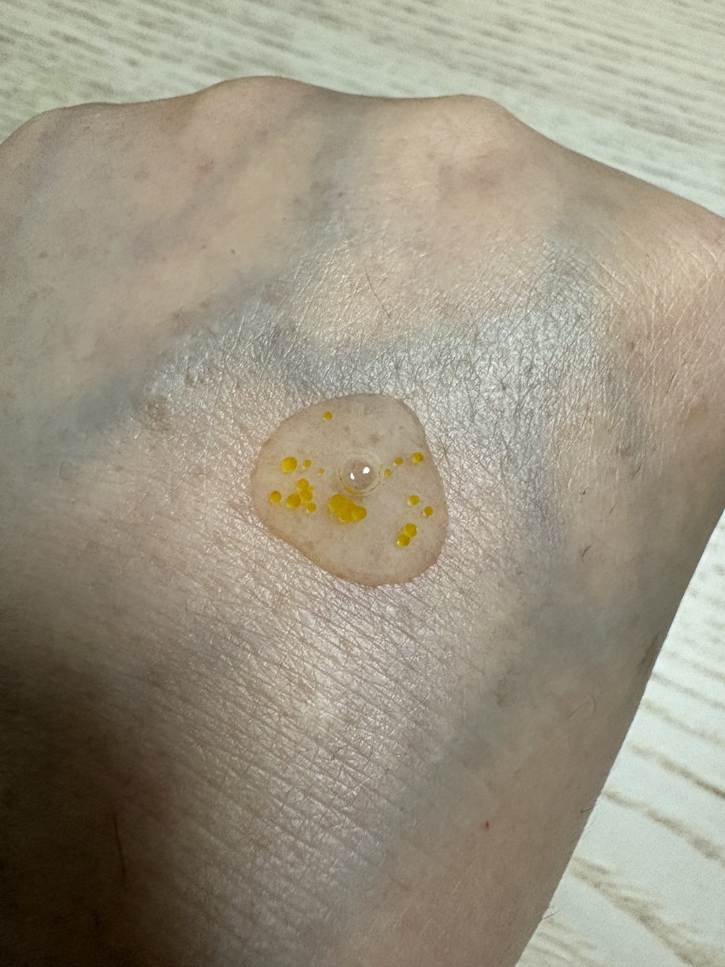 ダーメラ ルミショット・Wビタセラム/Dermela/美容液を使ったクチコミ（3枚目）