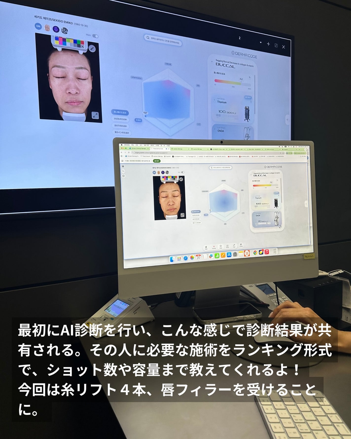 YUEMI on LIPS 「【PR】TheiAクリニック様ご提供今回の渡韓で糸リフトと唇フ..」(3枚目)
