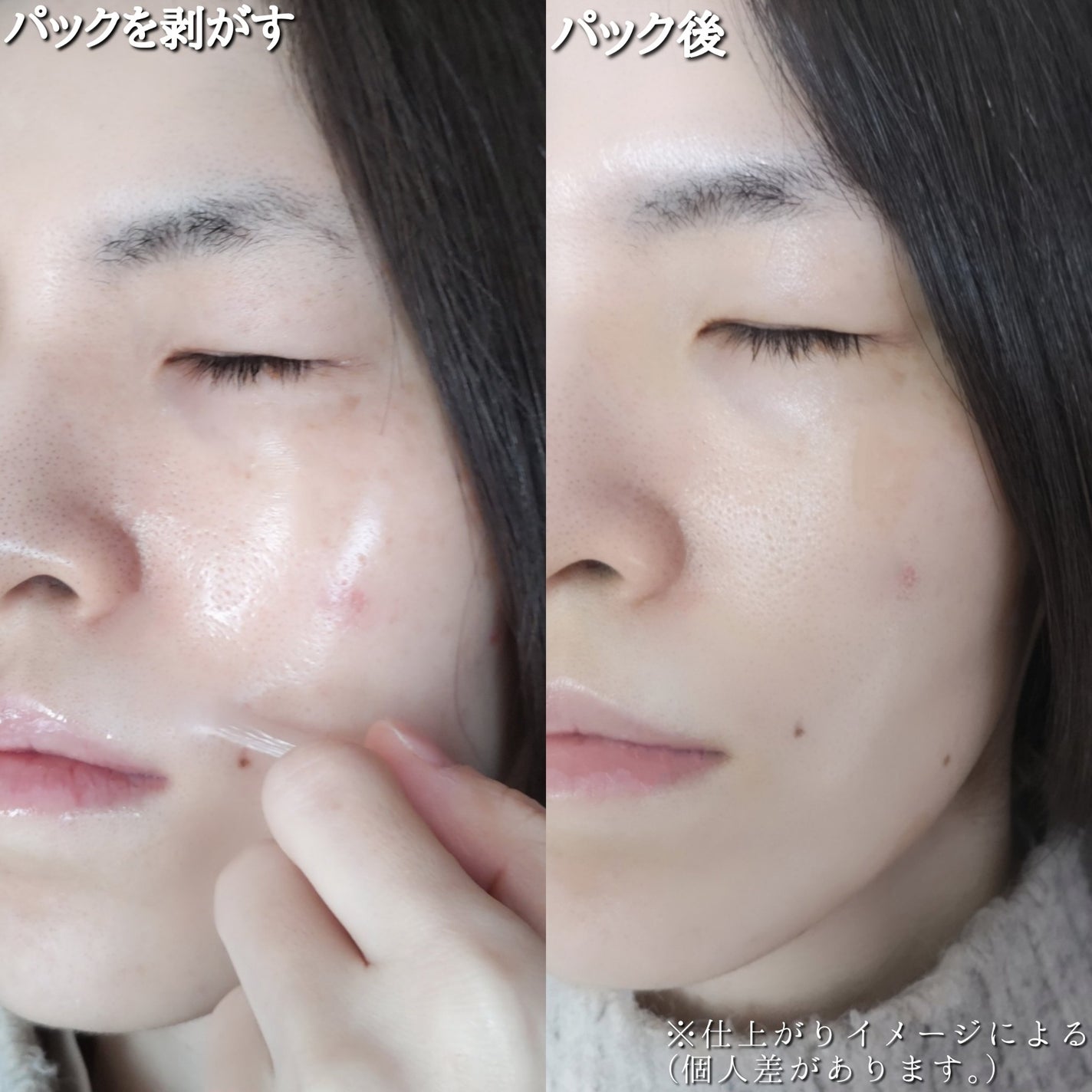 メラピールクリームマスク/CHARDE/ピーリングを使ったクチコミ(6枚目)