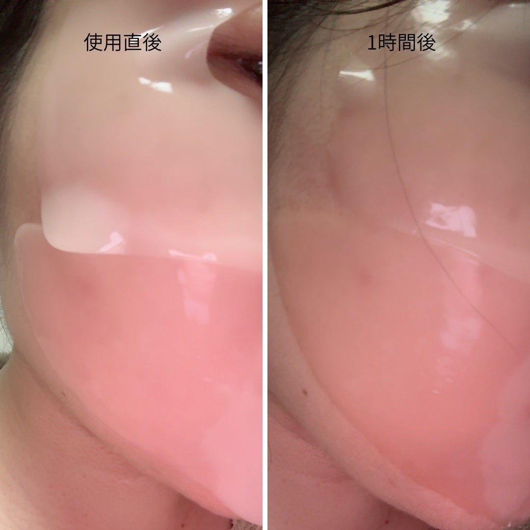 PDRNリジュべネティングフルインハイドロゲルマスク/SAM'U/シートマスク・パックを使ったクチコミ(3枚目)