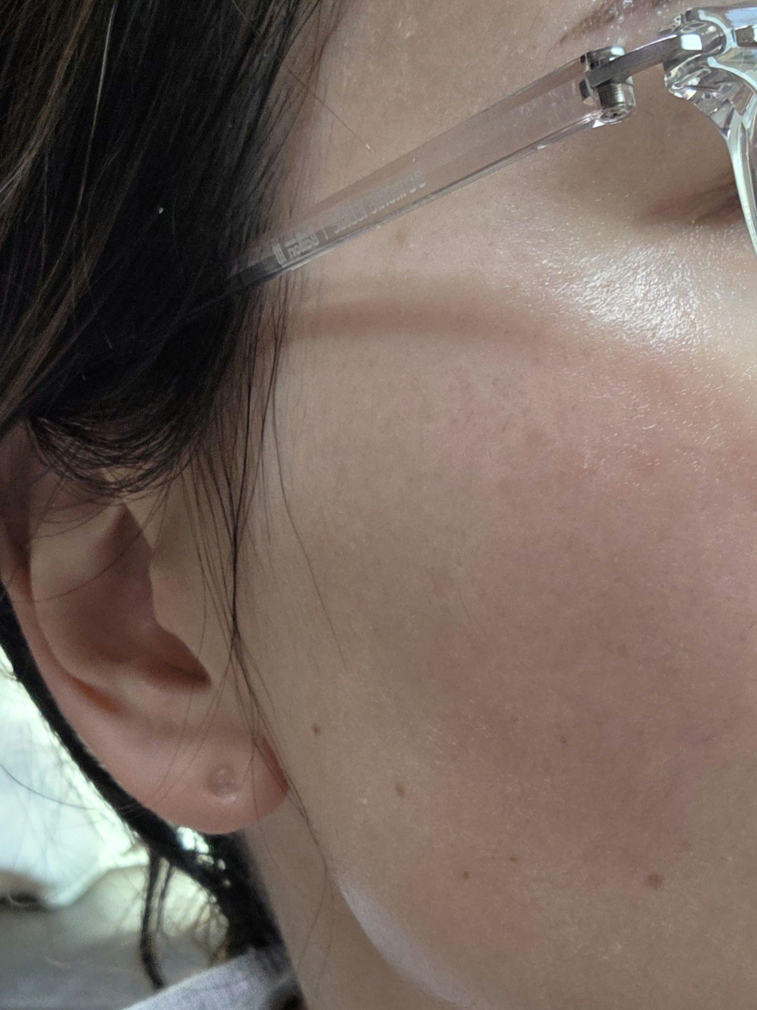 5 PDRN B5 バイタル スージング トナー/COSRX/化粧水を使ったクチコミ（3枚目）