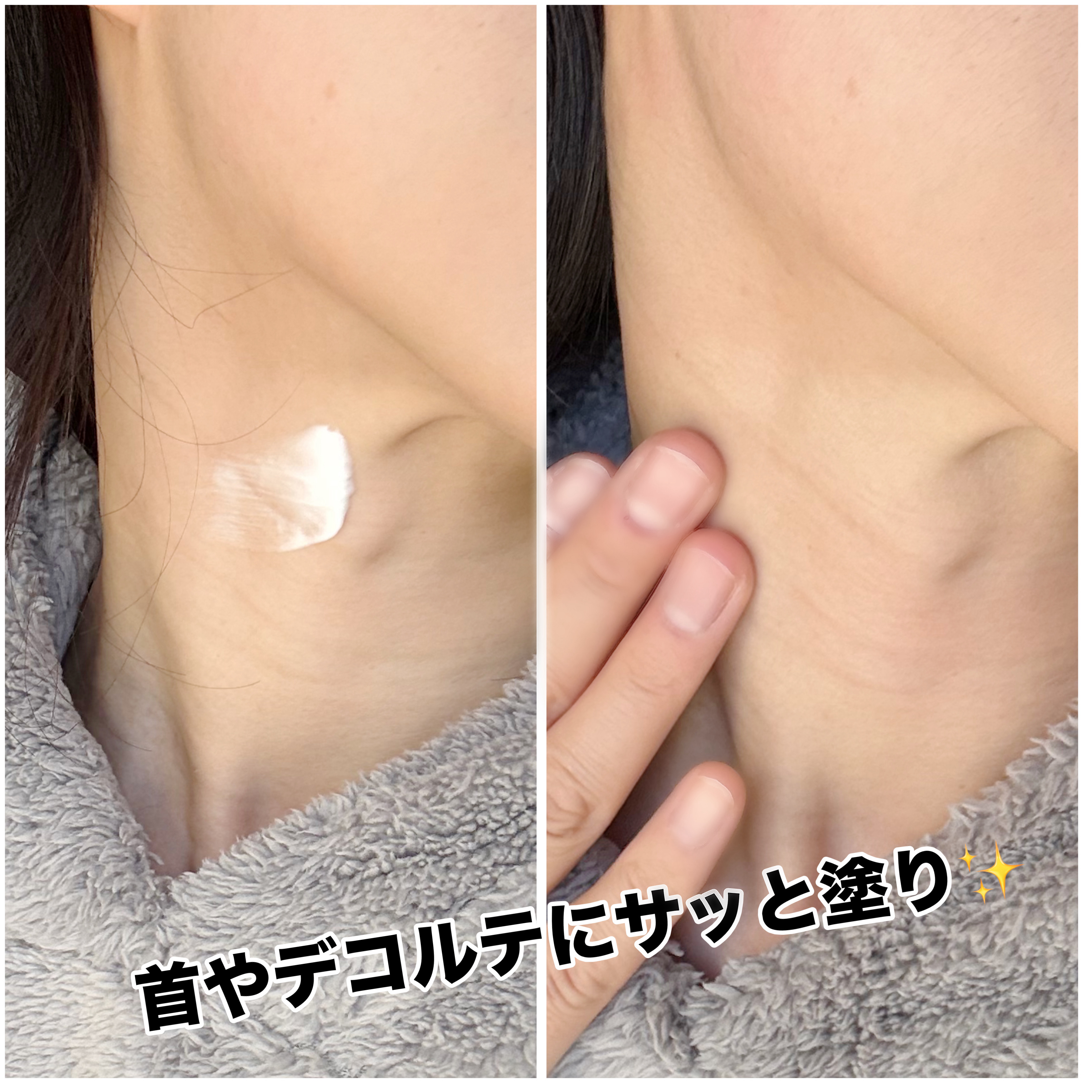 プレミアムナイテ スレッドネッククリーム/MEDIPEEL/ネック・デコルテケアを使ったクチコミ（3枚目）