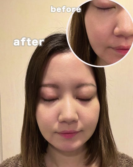 スタジオ フィックス ロングウエア クッション ファンデーション SPF 50/M・A・C/クッションファンデーションを使ったクチコミ(8枚目)