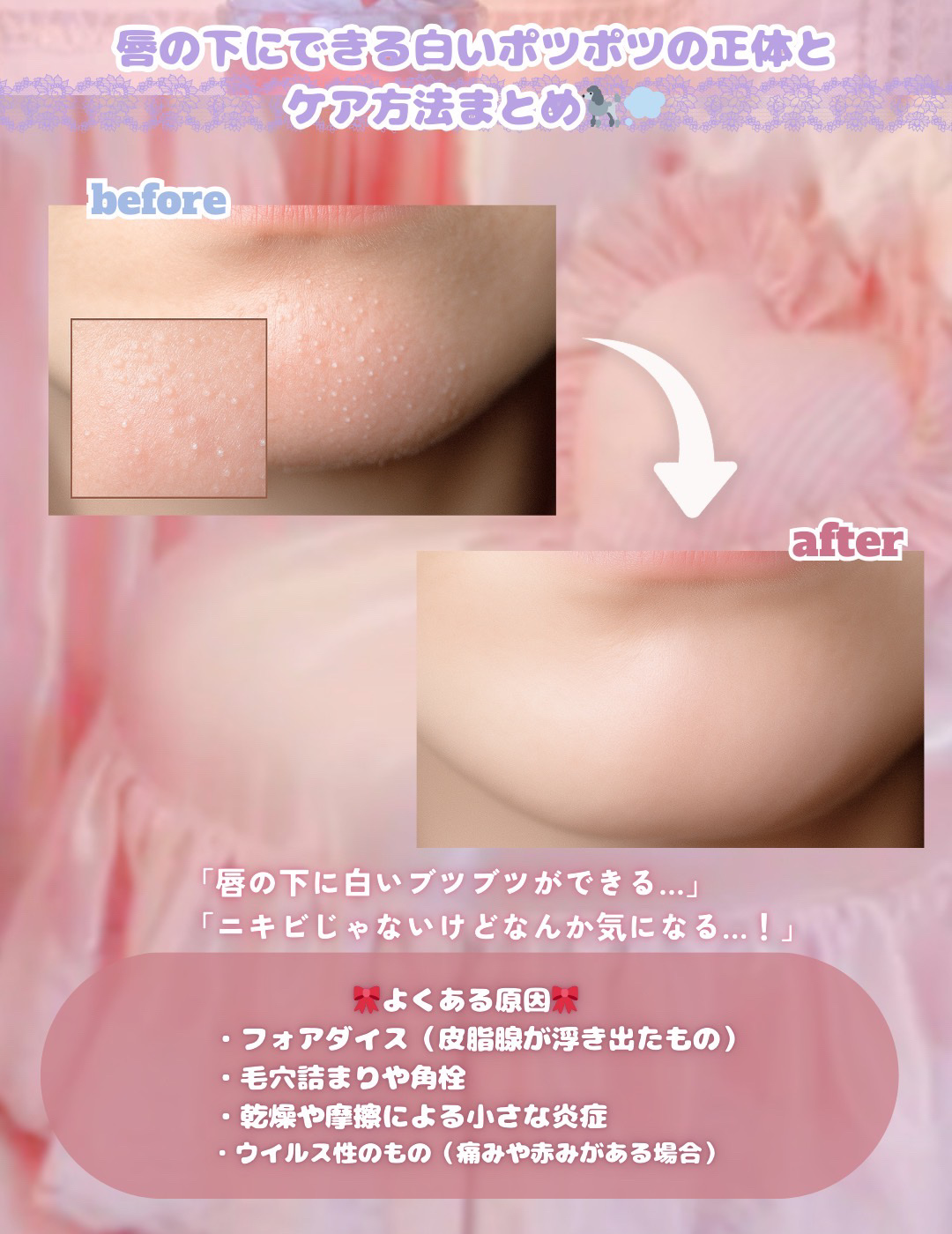 ケアセラ APフェイス＆ボディ乳液/ケアセラ/ボディミルクを使ったクチコミ（2枚目）