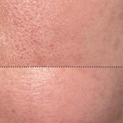 ペンタショット/CELORABY/美顔器・マッサージを使ったクチコミ(2枚目)