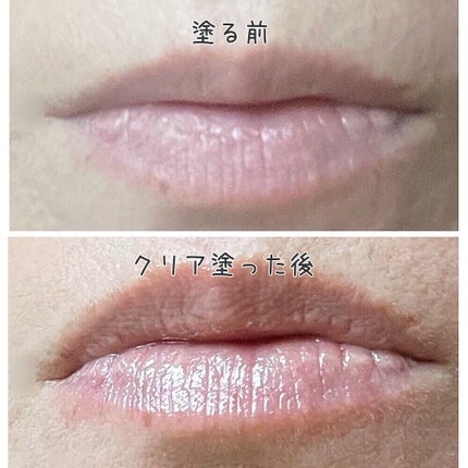 レチナールリップバーム/Dr.Different/リップバームを使ったクチコミ(4枚目)