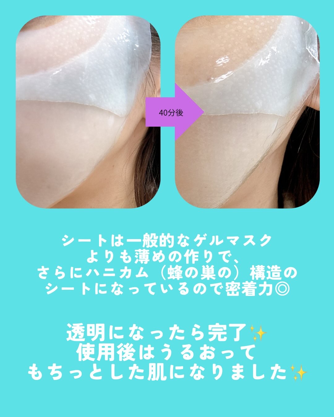 パーフェクト リアル パフォーマンス ヒアルコラーゲ ンマスクパック /ダーマフィックス/シートマスク・パックを使ったクチコミ（3枚目）