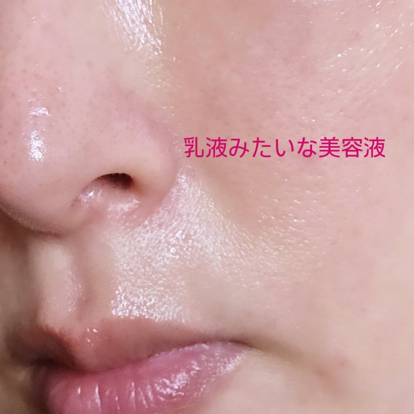 オカズ モチモチ/COSMEDON/美容液を使ったクチコミ(4枚目)