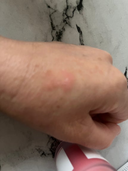 PDRNピンクアンプル PDRN 10,000ppm配合/MEDICUBE/美容液を使ったクチコミ(4枚目)