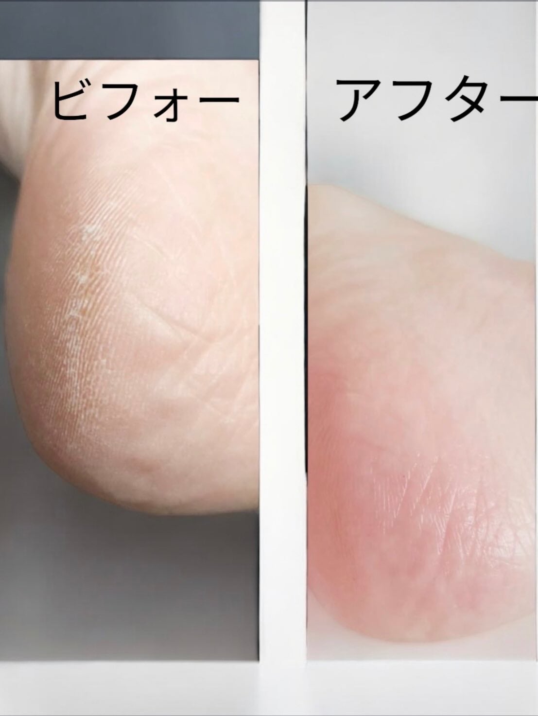 エリィ かかと削り ドッティ/ジュエル・コスメティックス/レッグ・フットケアを使ったクチコミ(3枚目)