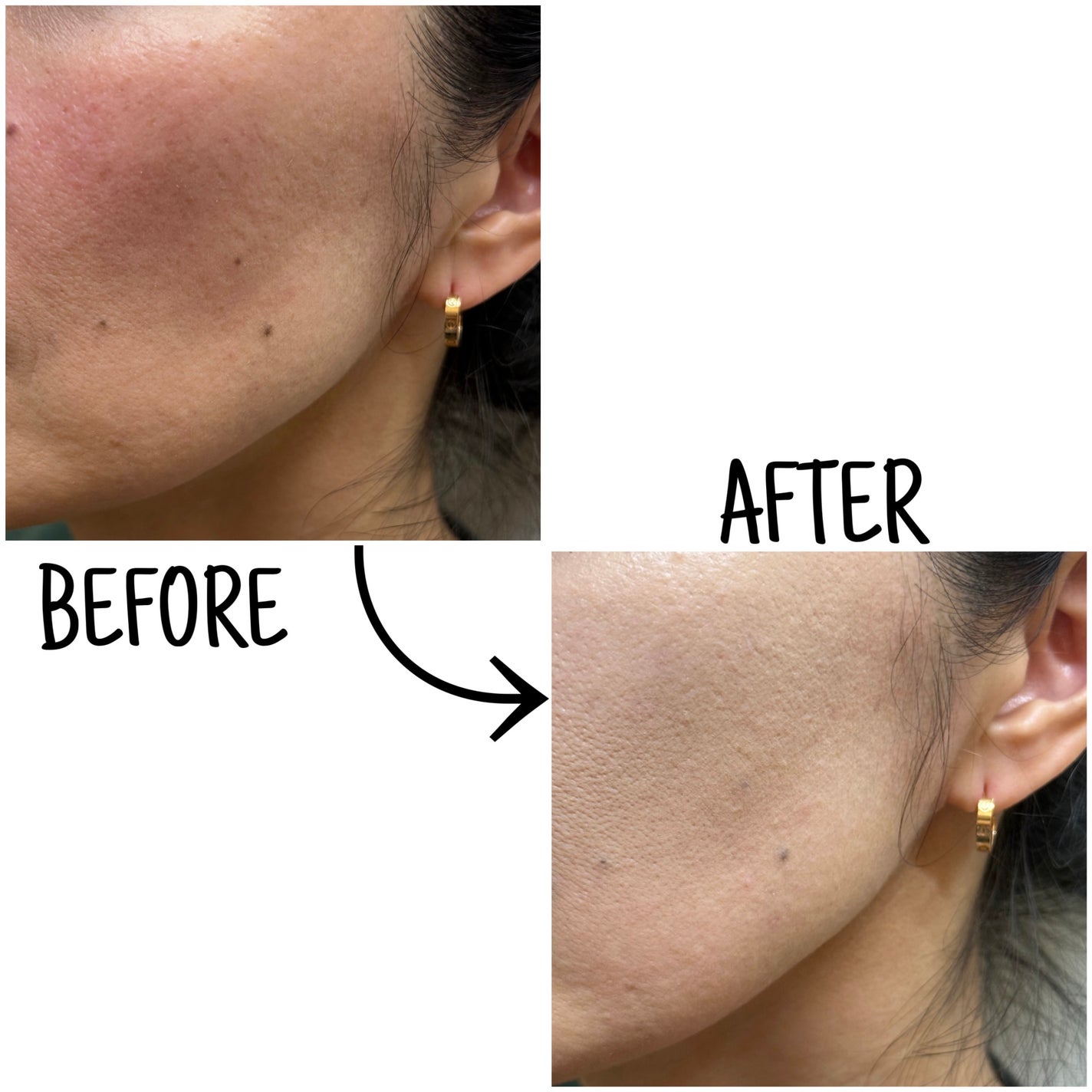 キルカバー メッシュ グロウ エッセンシャル クッション/CLIO/クッションファンデーションを使ったクチコミ(3枚目)