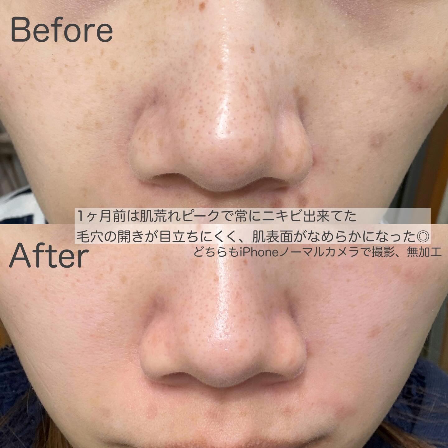 ペンタショット/CELORABY/美顔器・マッサージを使ったクチコミ（2枚目）