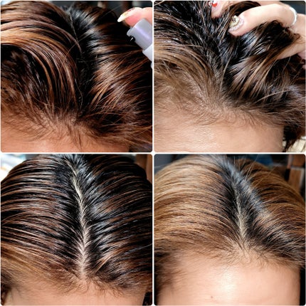 アデノバイタル スカルプ パワーショット/サブリミック/頭皮ローションを使ったクチコミ(3枚目)