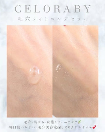 ポアタイトニングブーストセラム/CELORABY/美容液を使ったクチコミ(3枚目)