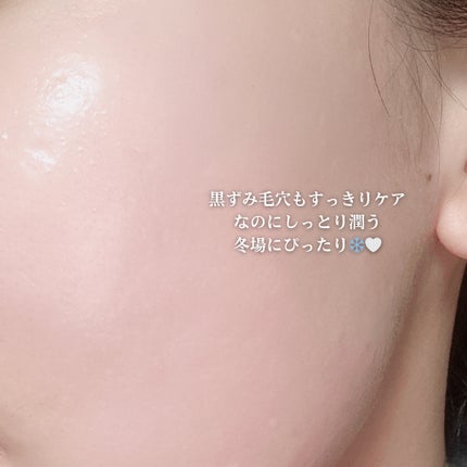 アズレンブルークレンジングバーム/原料工房/クレンジングバームを使ったクチコミ(4枚目)