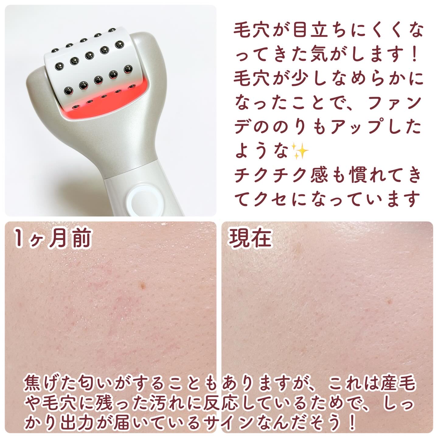 ペンタショット/CELORABY/美顔器・マッサージを使ったクチコミ（2枚目）