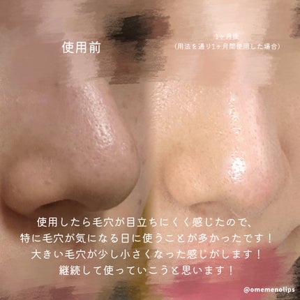 ペンタショット/CELORABY/美顔器・マッサージを使ったクチコミ(3枚目)