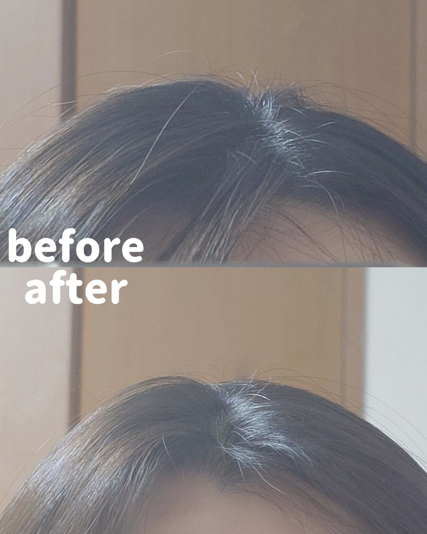 アデノバイタル スカルプ パワーショット/サブリミック/頭皮ローションを使ったクチコミ(4枚目)