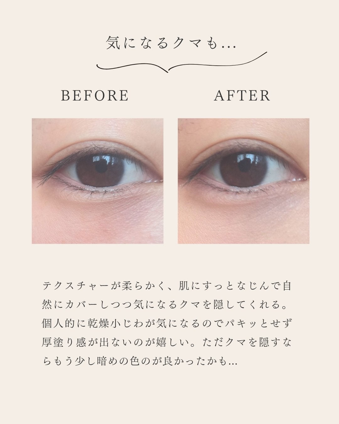 ディオールスキン フォーエヴァー スキン コレクト コンシーラー/Dior/リキッドコンシーラーを使ったクチコミ(3枚目)