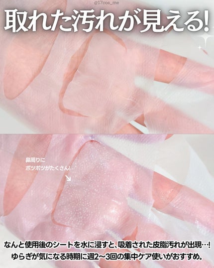 トラブルパッチマスク/EIOM/その他スキンケアを使ったクチコミ(4枚目)