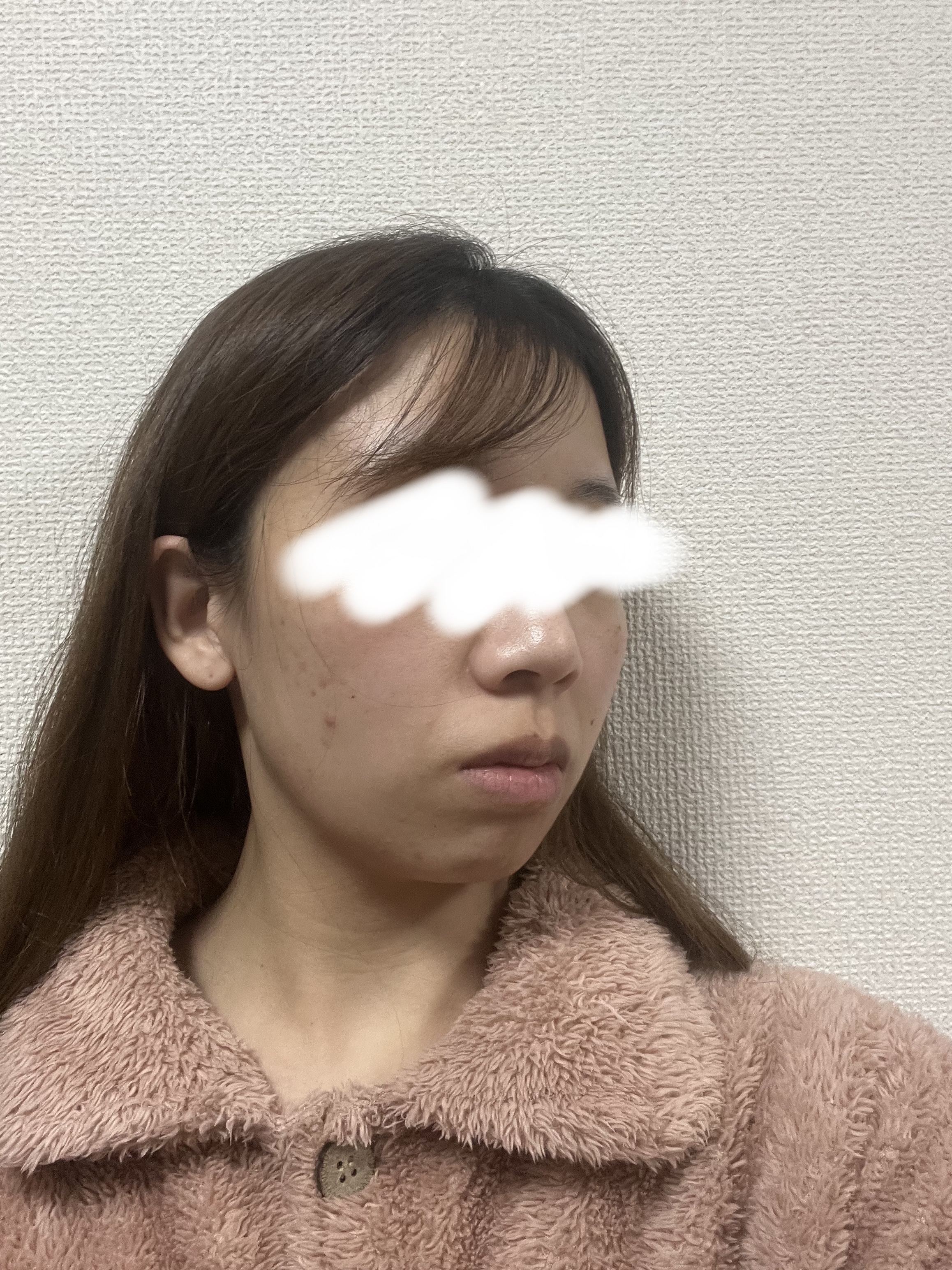 薬用 しみ 集中対策 美容液/メラノCC/美容液を使ったクチコミ（2枚目）