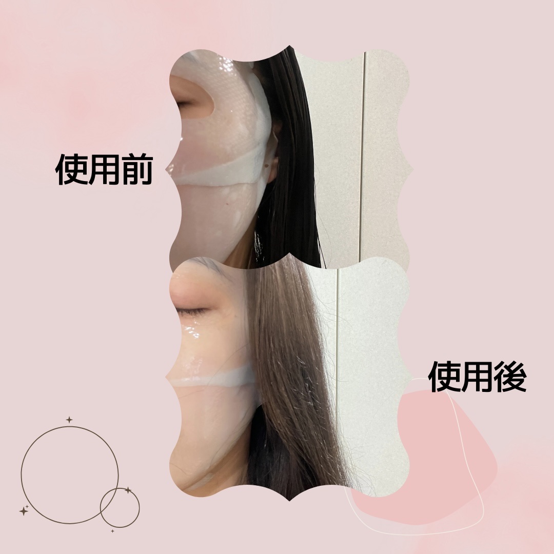 パーフェクト リアル パフォーマンス ヒアルコラーゲ ンマスクパック /ダーマフィックス/シートマスク・パックを使ったクチコミ（3枚目）