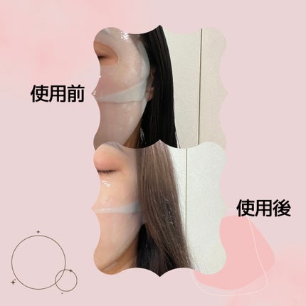 パーフェクト リアル パフォーマンス ヒアルコラーゲ ンマスクパック /ダーマフィックス/シートマスク・パックを使ったクチコミ(3枚目)