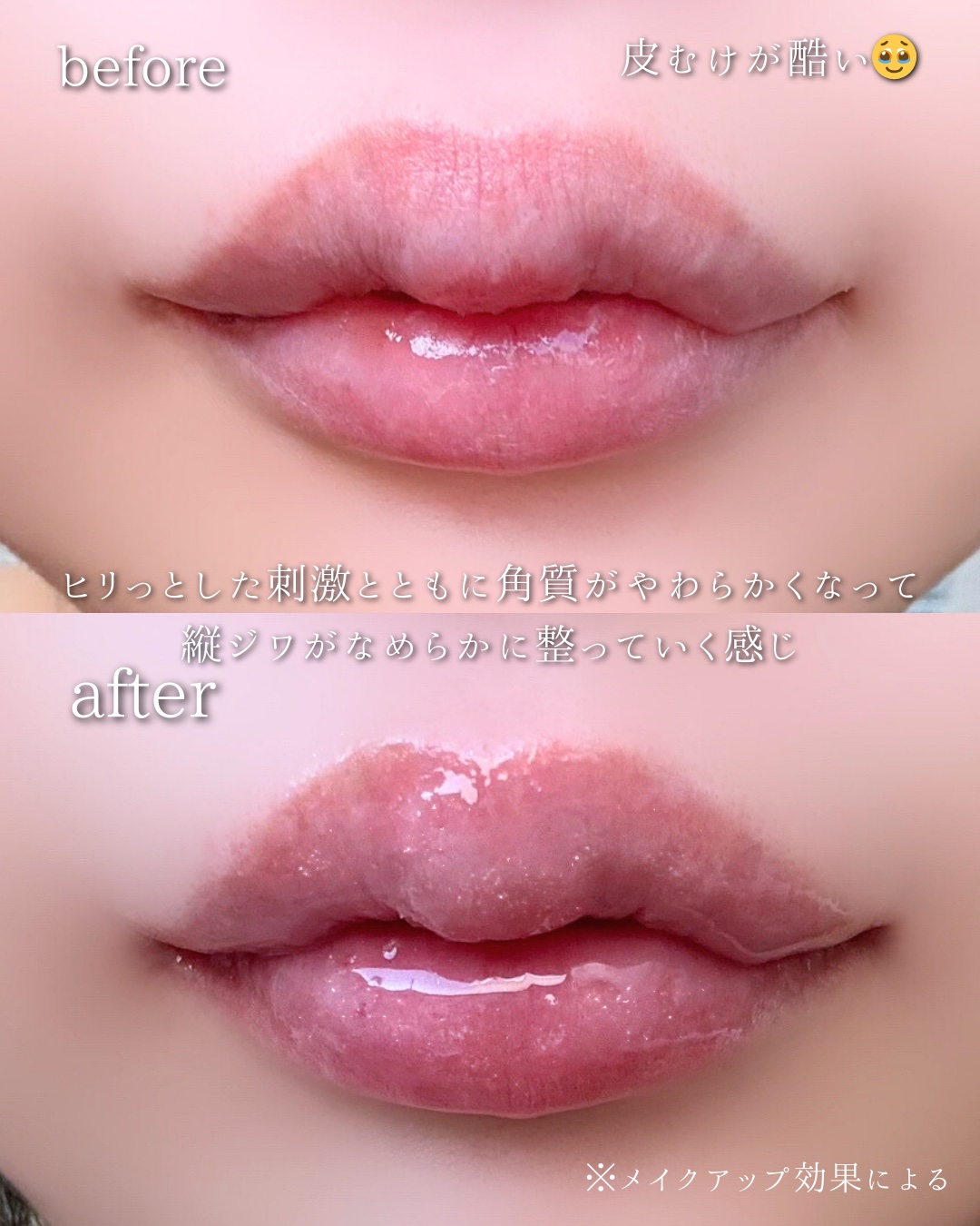 フレイムライトリッププランパー/LoNLy /リッププランパーを使ったクチコミ（3枚目）