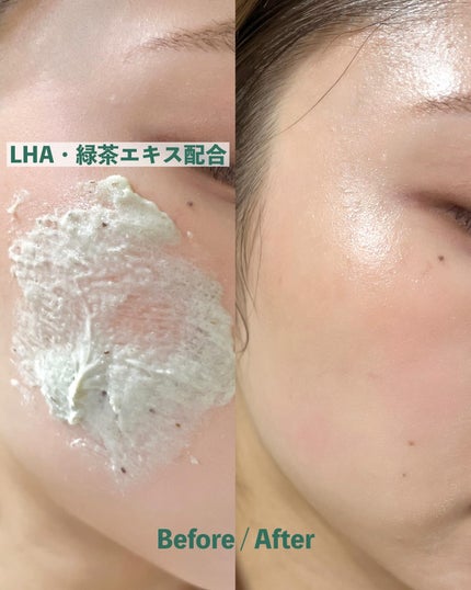 グリーンティー LHA ディープポアもちソープクレンザー/アレンシア/洗顔フォームを使ったクチコミ(3枚目)