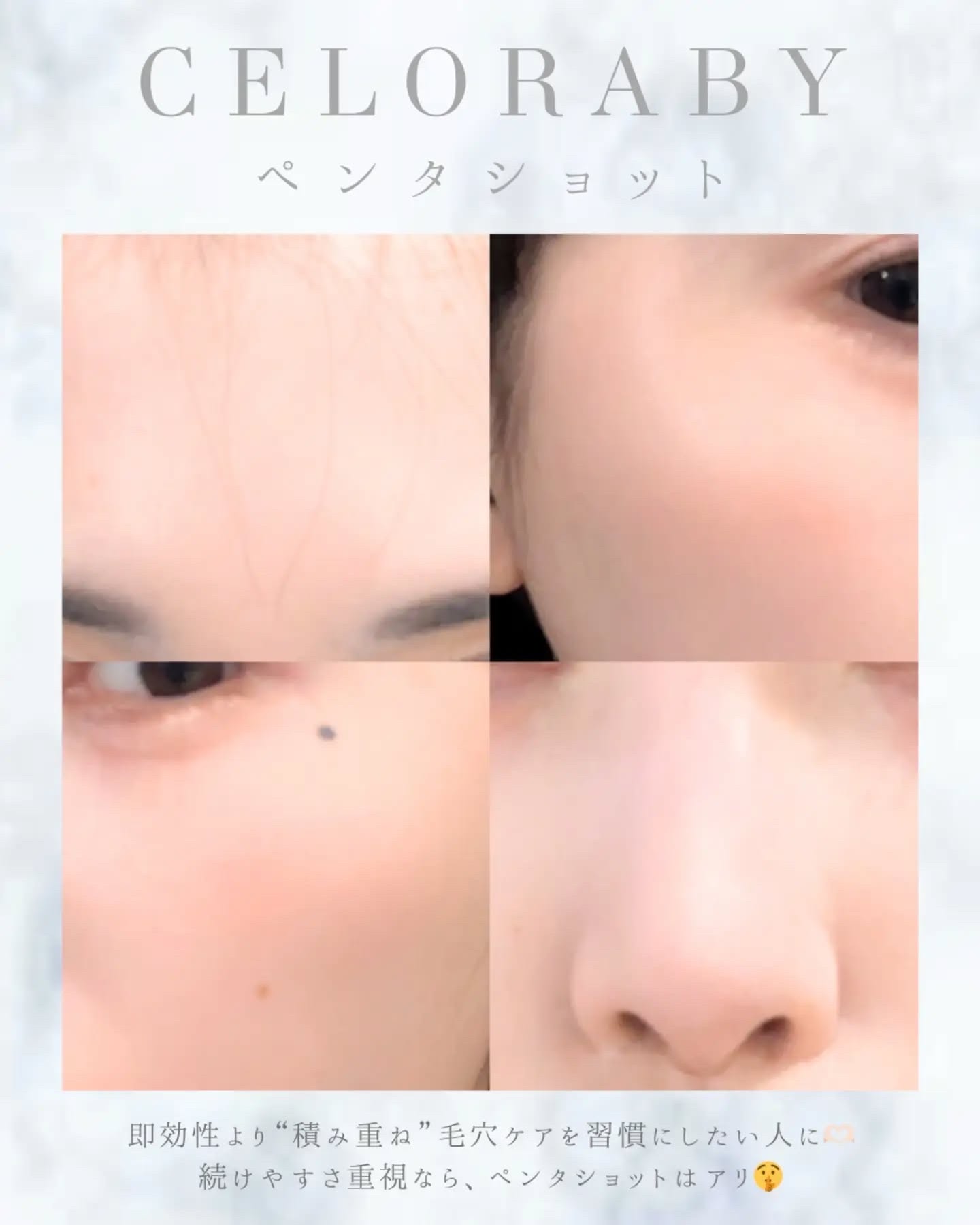 ペンタショット/CELORABY/美顔器・マッサージを使ったクチコミ（3枚目）