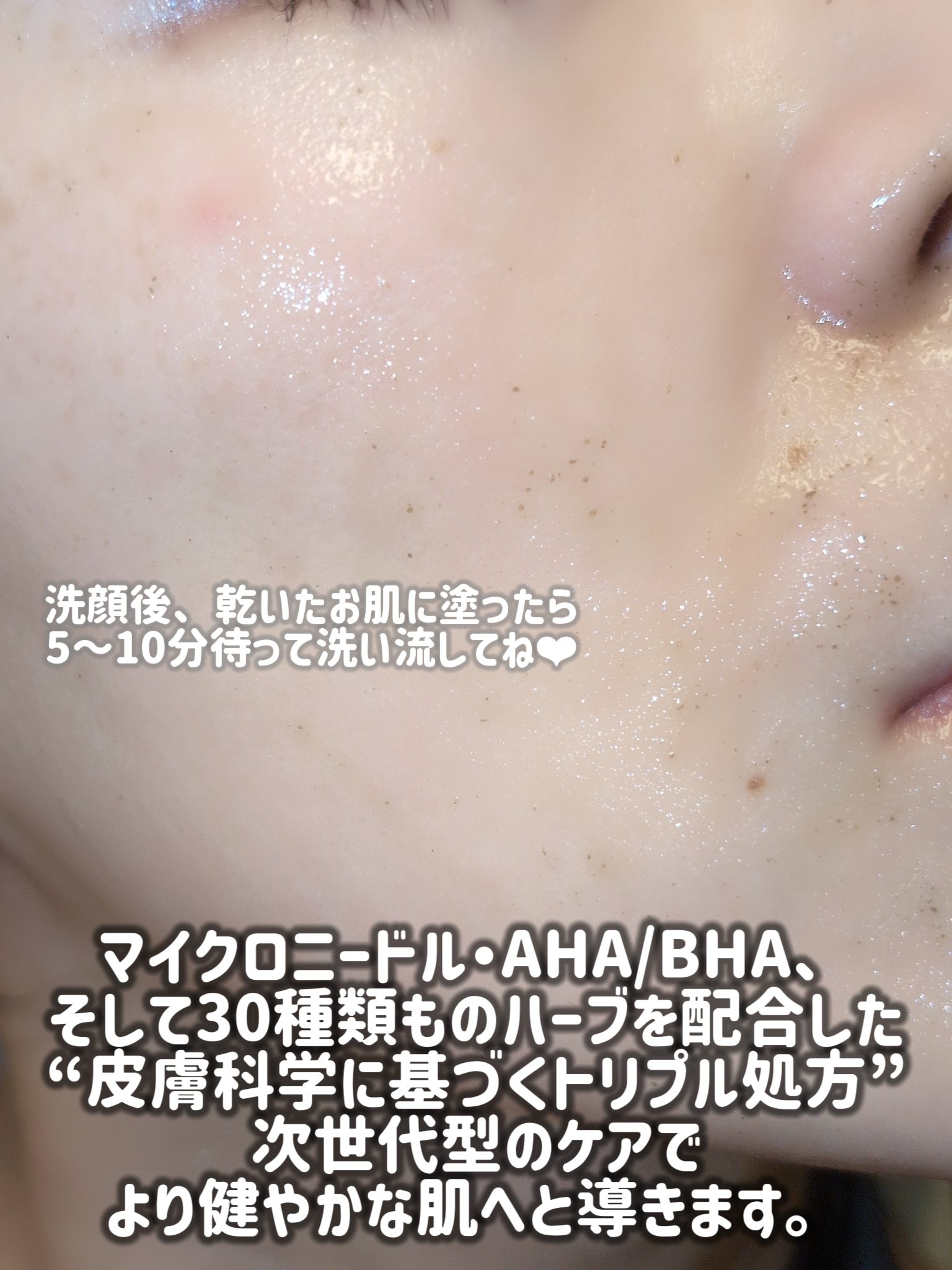 ハーブピーリング/on:myskin/ピーリングを使ったクチコミ（3枚目）