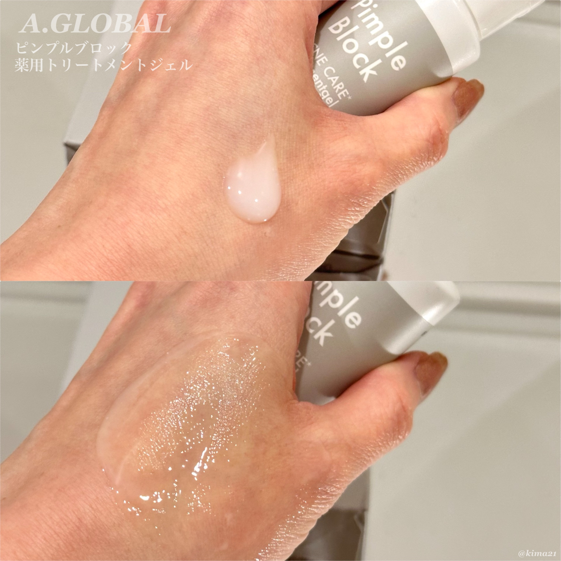 Pimple Block ピンプルブロック アクネ洗顔（医薬部外品）のクチコミ「#PR 

A.GLOBAL
Pimple Block(ピンプルブロック)
※トライアルセット.....」（3枚目）