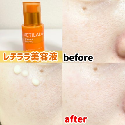 ブラックPDRN 美容液/ネイチャーリパブリック/美容液を使ったクチコミ(4枚目)