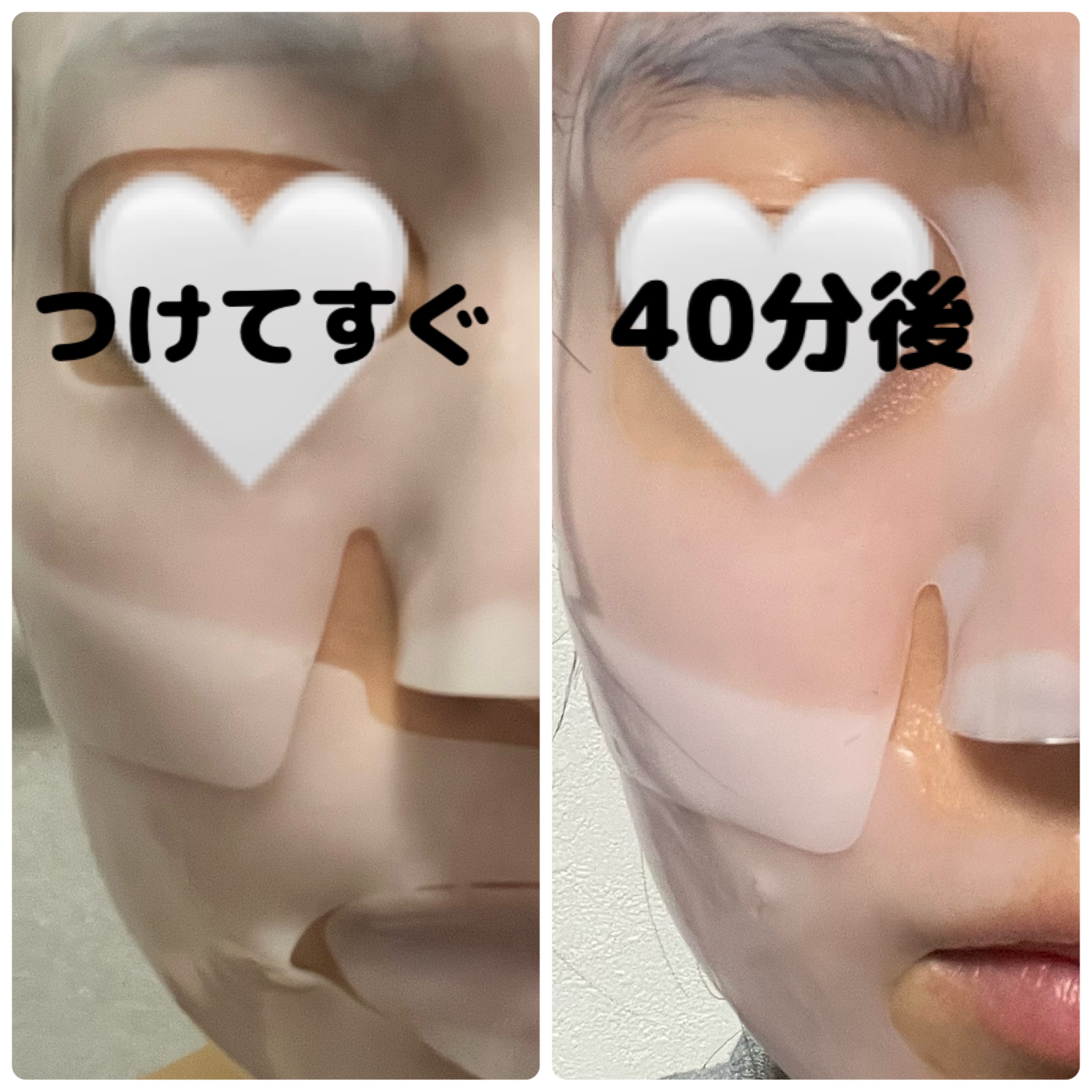 コラーゲン リードルショット100 2ステップハイドロゲルマスク/VT/シートマスク・パックを使ったクチコミ（3枚目）