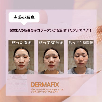 パーフェクト リアル パフォーマンス コラーゲンマスクパック /ダーマフィックス/シートマスク・パックを使ったクチコミ(4枚目)
